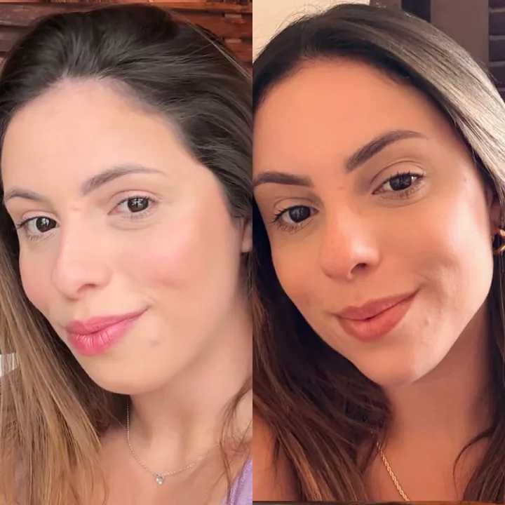 Case de harmonização facial